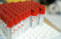 20.01.2022 Оперштаб Приморья: Заболеваемость COVID-19 растет, смертность не снижается | Администрация муниципального округа город Партизанск Приморского края Официальный сайт